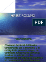 hipertiroidismo