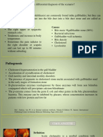 Cholelithiasis: Clinical Symtomps Causes