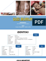 Gizi Buruk