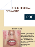 Rosacea & Perioral Dermatitis: Esther Nimisha