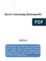 Garre's Sclerosing Osteomyelitis