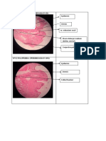 Ov2 Palpebra (Perbesaran 4X) : Epidermis