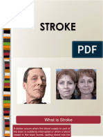 Stroke