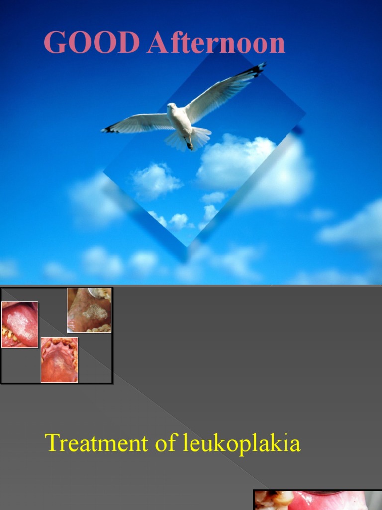 Leukoplakia Treatment PDF Clinical Medicine Dose (Biochemistry)