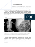 NEC (Necrotizing Enterocolitis) Radiology