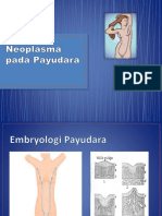 kuliah breast tumor-Bedah.pptx