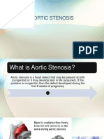 Aortic Stenosis