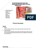 Fistula Genetalis