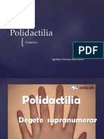 Polidactilia Spataru Narcisa.pptx