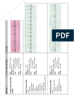 EKG Flash Cards.pdf