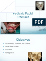 Pediatric Facial Fracture