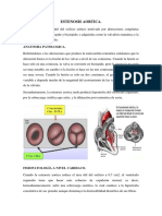 Esternosis Aortica