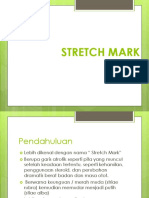 Stretch Mark