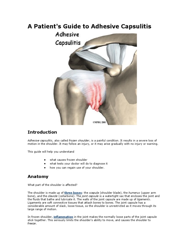 A Patient's Guide To Adhesive Capsulitis PDF Shoulder Anesthesia