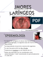 Tumores Laringeos