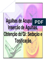 Acupuntura Abdominal PDF