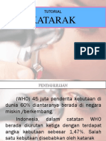 KATARAK