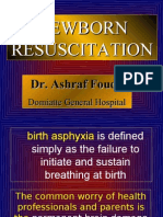 Newborn Resuscitation