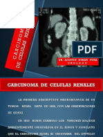 Carcinoma de Celulas Renales