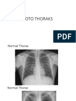 Foto Thorax