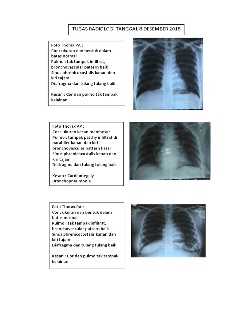 Pussy külotdan tashqariga qaraydi