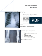 Tugas Radiologi