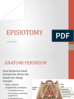 Episiotomy