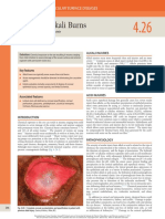 Acid and Alkali Burns: Part 4 Cornea and Ocular Surface Diseases