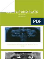 Cleft Lip Palate Case Masticatory Rehabilitation Fibula Flap