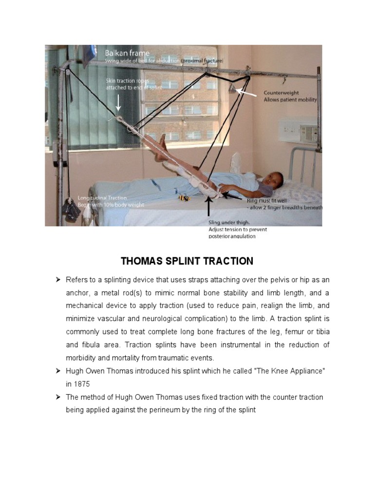 Thomas Splint Traction