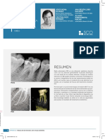 Influencia Del Radix Entomolaris Sobre La Terapia Endodontica. A Proposito de Un Caso PDF