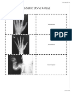 Pediatric Bone X-Ray Flashcards