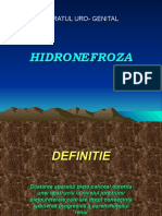 hidronefroza.ppt