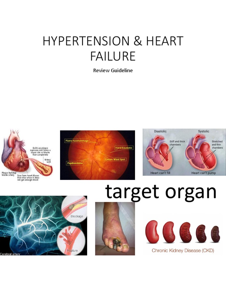 Hypertension & Heart Failure | PDF