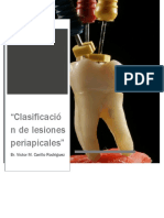 Clasificacion de Lesiones Periapicales