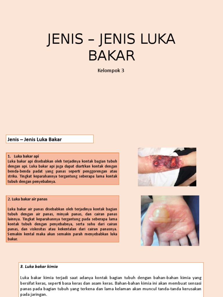 Jenis Jenis Luka Bakar Pdf