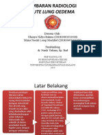 Acute Lung Oedema: Gambaran Radiologi