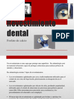 Revestimiento Dental