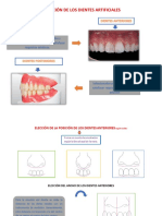 Folleto Protesis Total