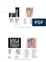 Dhila-Mri Abses