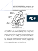 GAMBARAN RADIOLOGIS EDEMA PARU