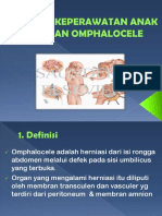 Omphalocele