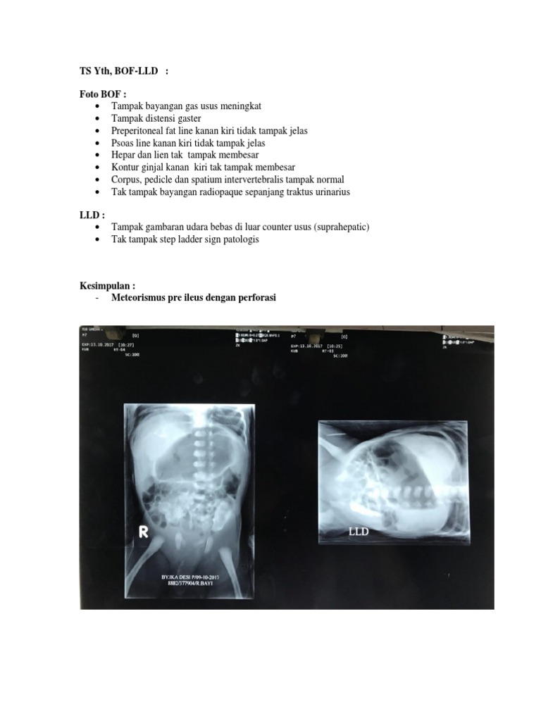 Meteorismus Pre Ileus pada LLD X-Ray | PDF | Agama & Spiritualitas ...