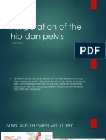 Amputation of The Hip Dan Pelvis