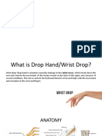 Drop Hand Referat Neuro