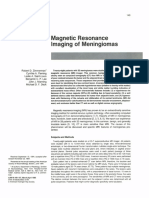 Magnetic Resonance Imaging of Meningiomas