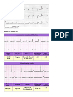 Normal Ecg.. Normal Axis