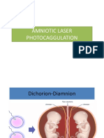Amniotic Laser Photocoagulation