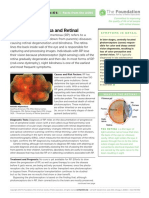 Fact Sheet 14 Retinitis Pigmentosa and Retinal Prosthesis New