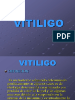 Vitiligo